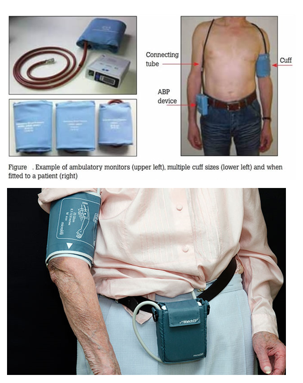 ambultaroy blood pressure monitor.PNG